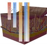 Superpulsed vs. Continuous Wave